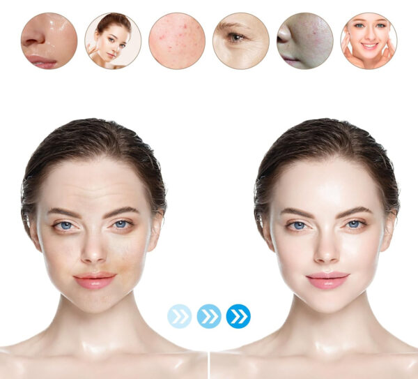 Dermapen Dr.Pen Ultima M8S bezprzewodowy 6 prędkości 0-2.5mm regulacja - obrazek 3
