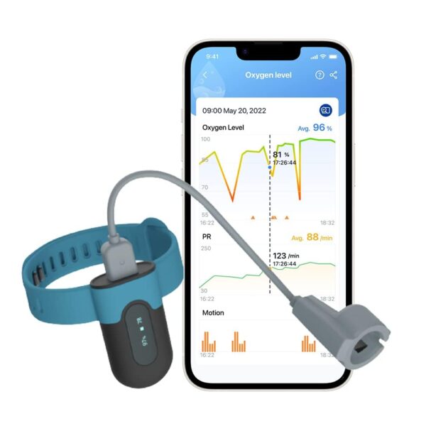 Pulsoksymetr ViATOM SleepU dla Androida i iOS z aplikacją monitor snu saturacji